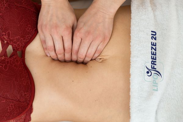 diastasis recti treatment Hastings