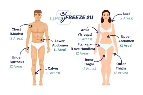 Areas you can have fat freezing treatment Hastings