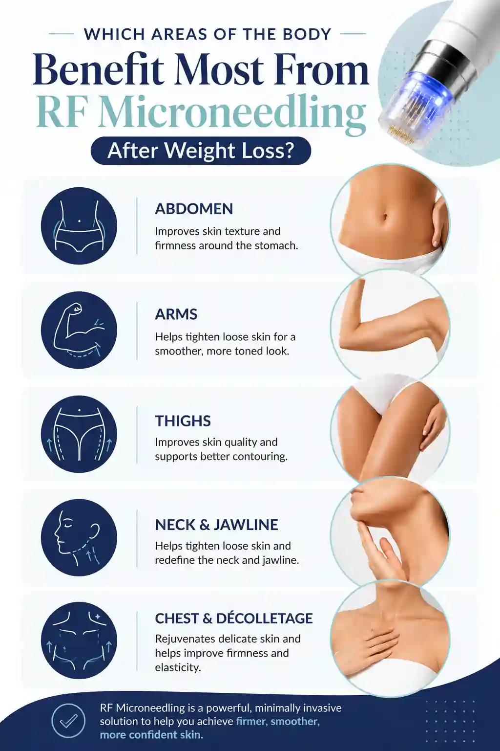 Which Areas of the Body Benefit Most From RF Microneedling After Weight Loss Hastings